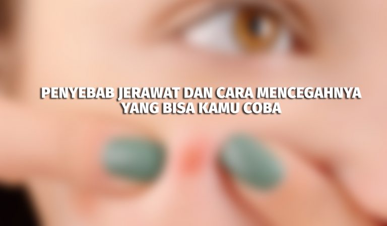 Penyebab Jerawat Dan Cara Mencegahnya Yang Bisa Kamu Coba | Ciungtips™